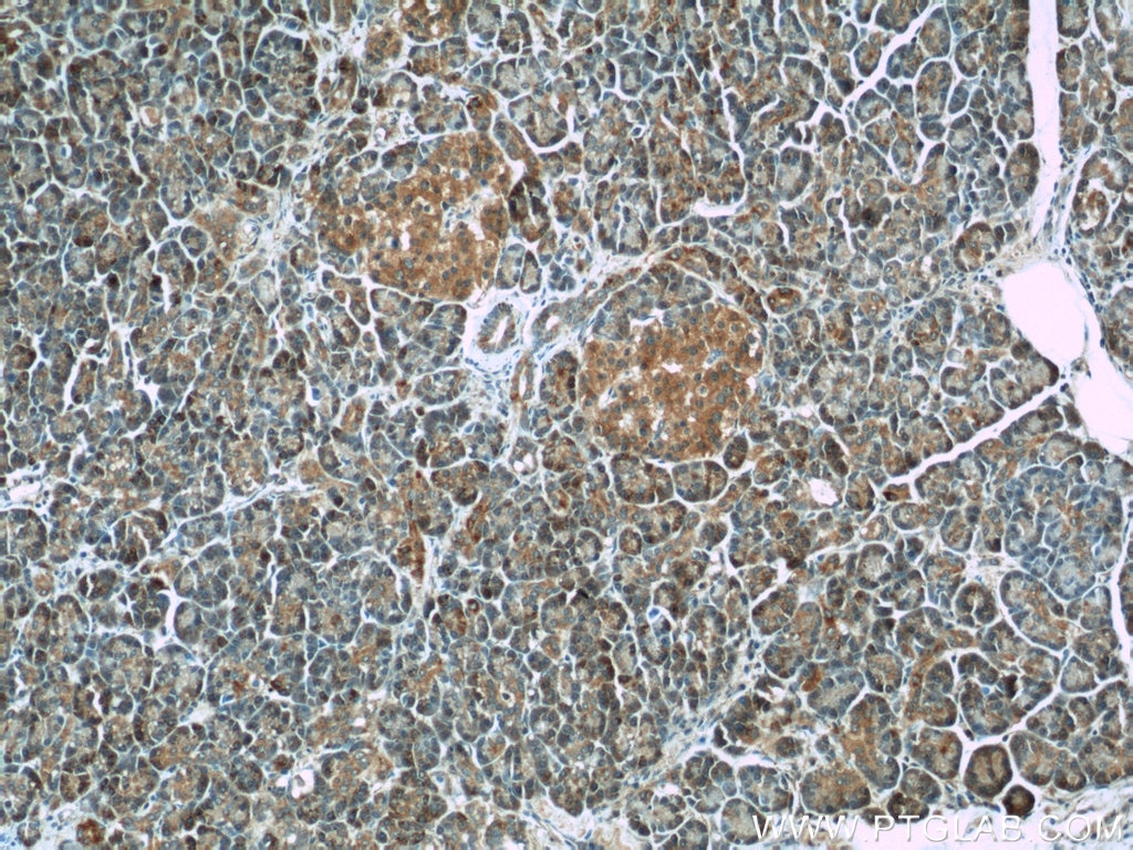 Immunohistochemistry (IHC) staining of human pancreas tissue using NPRL2 Polyclonal antibody (10157-1-AP)