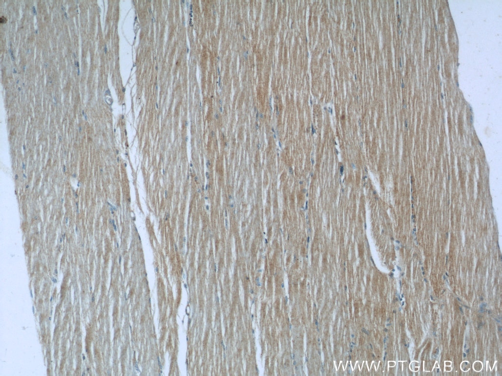 IHC staining of human skeletal muscle using 10157-1-AP