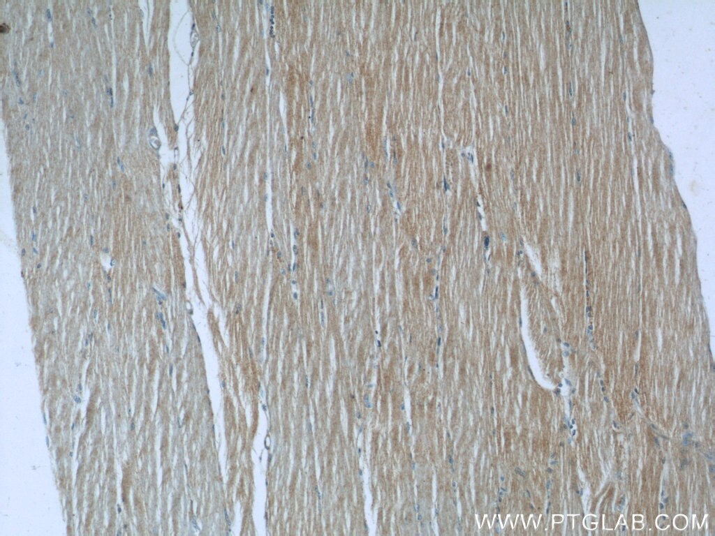 Immunohistochemistry (IHC) staining of human skeletal muscle tissue using NPRL2 Polyclonal antibody (10157-1-AP)