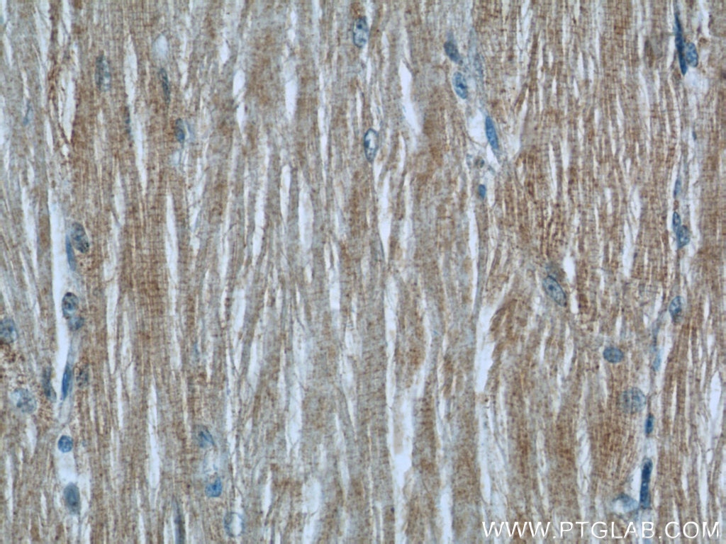 IHC staining of human skeletal muscle using 10157-1-AP