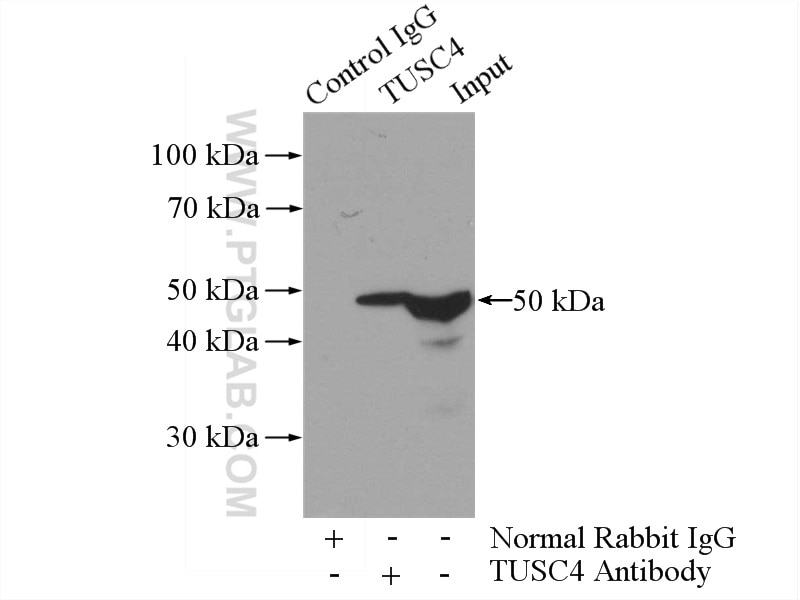 Immunoprecipitation (IP) experiment of mouse pancreas tissue using NPRL2 Polyclonal antibody (10157-1-AP)