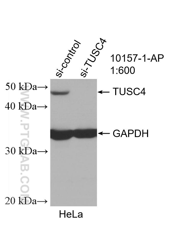 WB analysis of HeLa using 10157-1-AP