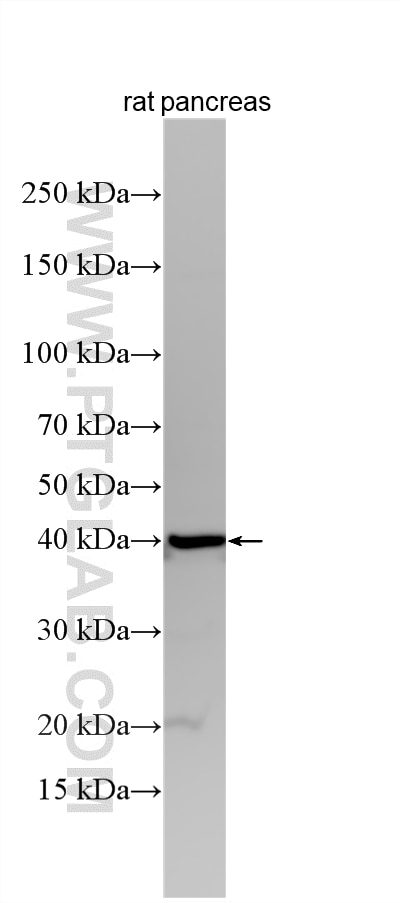 Various lysates were subjected to SDS PAGE followed by western blot with 10157-1-AP (NPRL2 antibody) at dilution of 1:6000 incubated at room temperature for 1.5 hours. Western Blot (WB) analysis of various lysates using NPRL2 Polyclonal antibody (10157-1-AP)