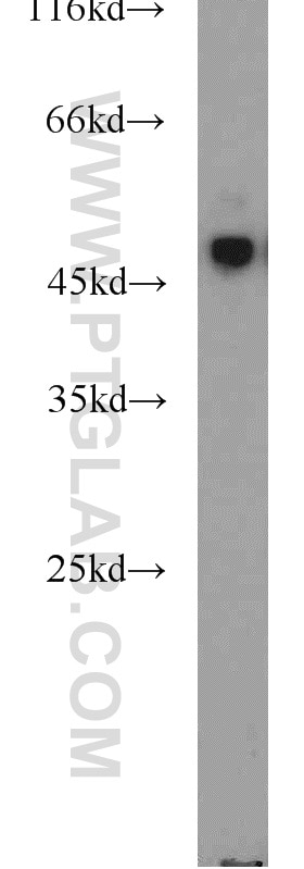 Western Blot (WB) analysis of mouse pancreas tissue using NPRL2 Polyclonal antibody (10157-1-AP)