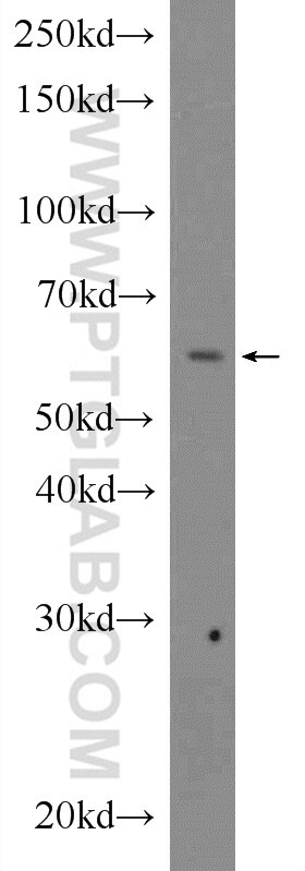 Western Blot (WB) analysis of HEK-293 cells using NPR3 Polyclonal antibody (25248-1-AP)