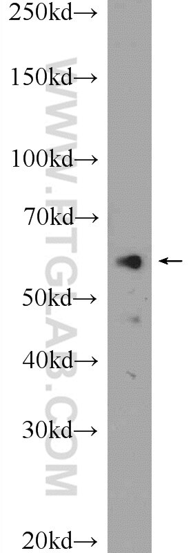 Western Blot (WB) analysis of HL-60 cells using NPR3 Polyclonal antibody (25248-1-AP)