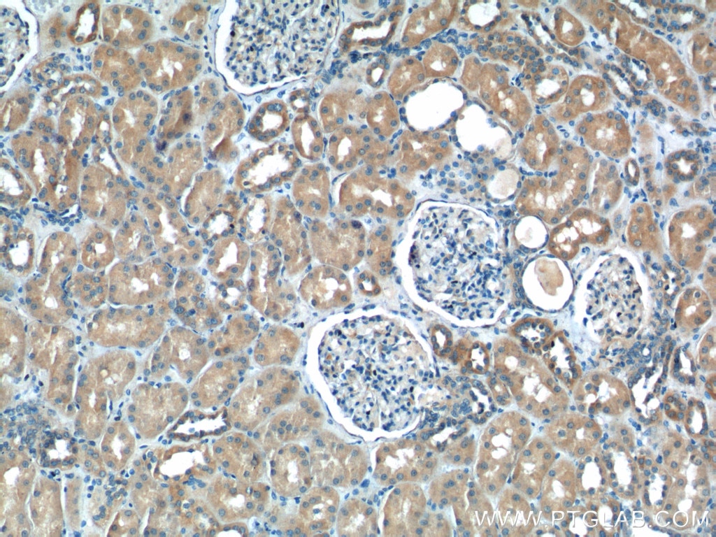 Immunohistochemistry (IHC) staining of human kidney tissue using NPR3 Polyclonal antibody (26706-1-AP)