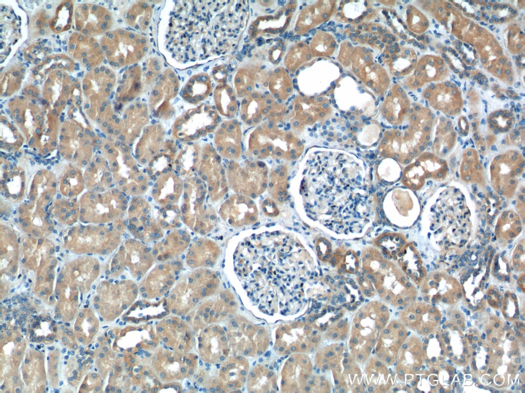 Immunohistochemistry (IHC) staining of human kidney tissue using NPR3 Polyclonal antibody (26706-1-AP)