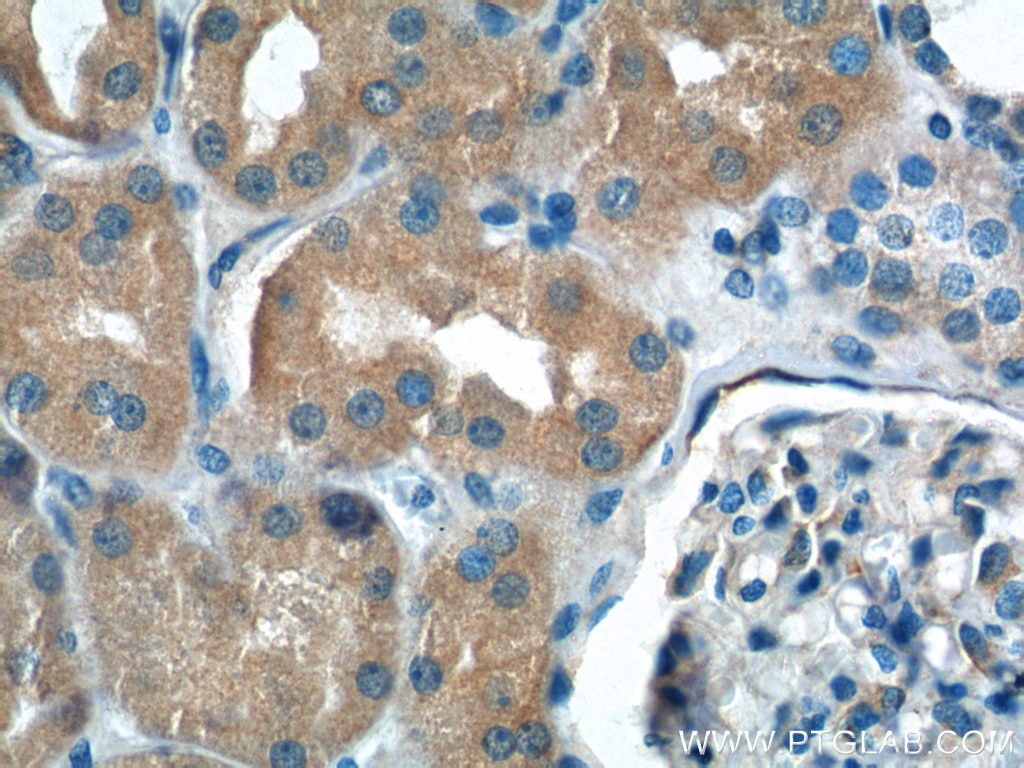 Immunohistochemistry (IHC) staining of human kidney tissue using NPR3 Polyclonal antibody (26706-1-AP)