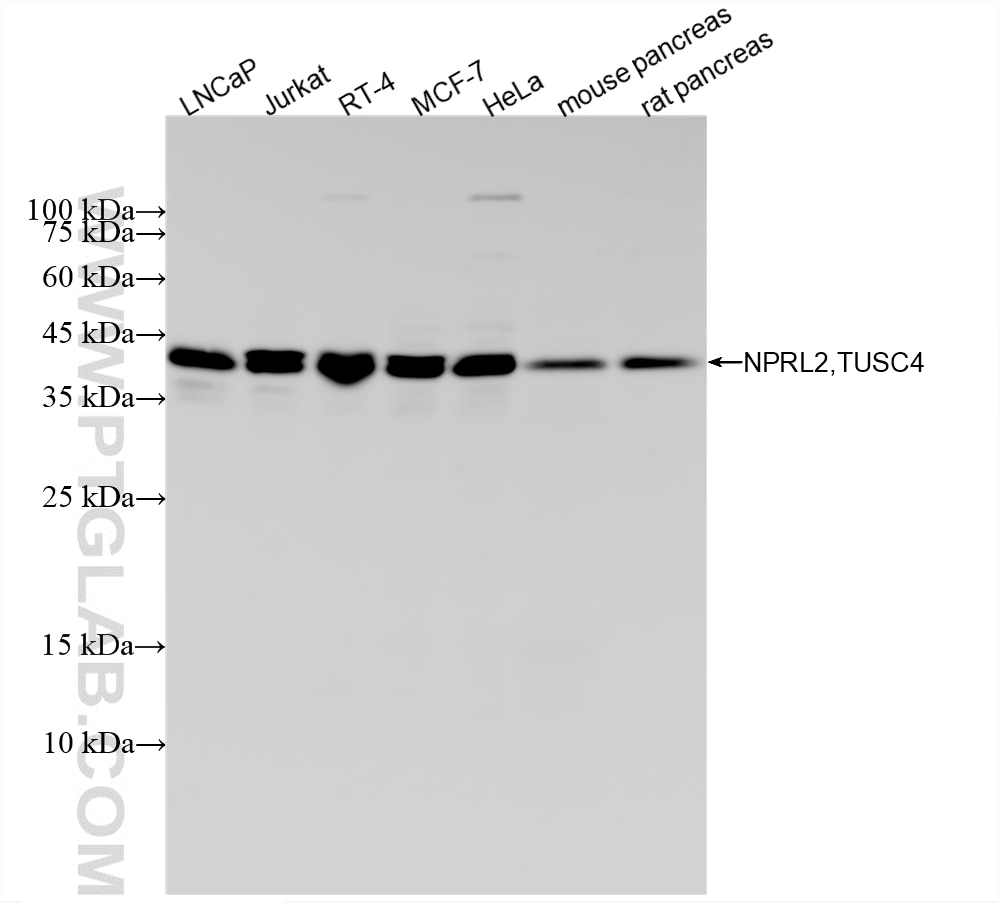 WB analysis using 88066-1-RR (same clone as 88066-1-PBS) Western Blot (WB) analysis of various lysates using NPRL2,TUSC4 Recombinant monoclonal antibody (88066-1-RR)