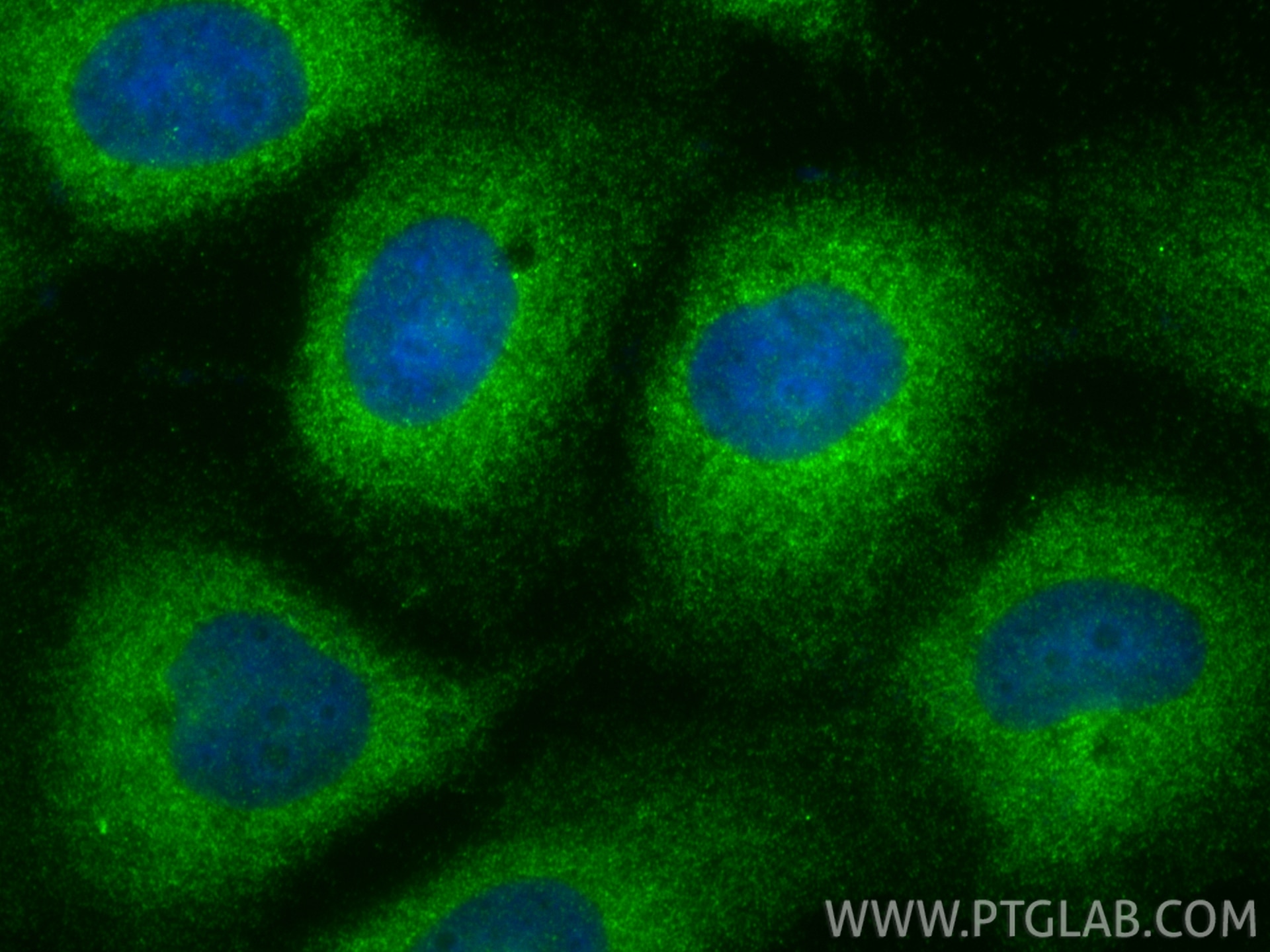 IF Staining of A431 using 26446-1-AP (same clone as 26446-1-PBS) Immunofluorescence (IF) / fluorescent staining of A431 cells using NPRL3 Polyclonal antibody (26446-1-AP)