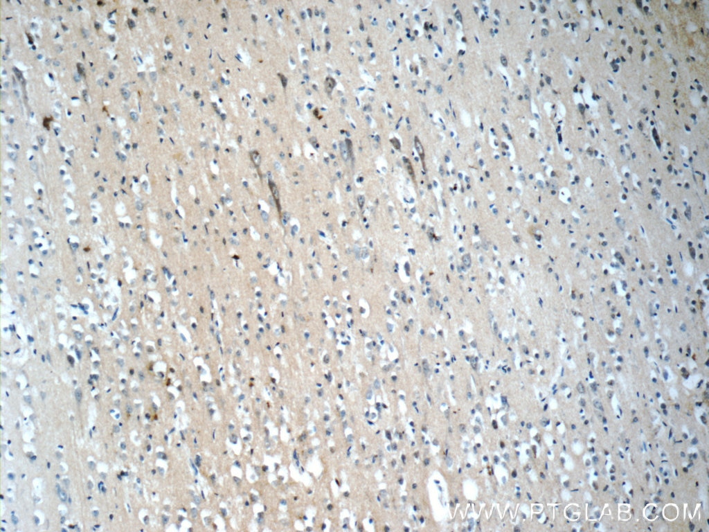 Immunohistochemistry (IHC) staining of human brain tissue using NPS Polyclonal antibody (23609-1-AP)