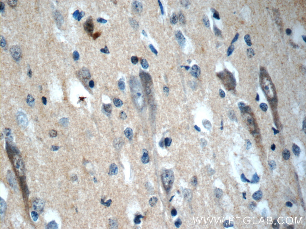 Immunohistochemistry (IHC) staining of human brain tissue using NPS Polyclonal antibody (23609-1-AP)