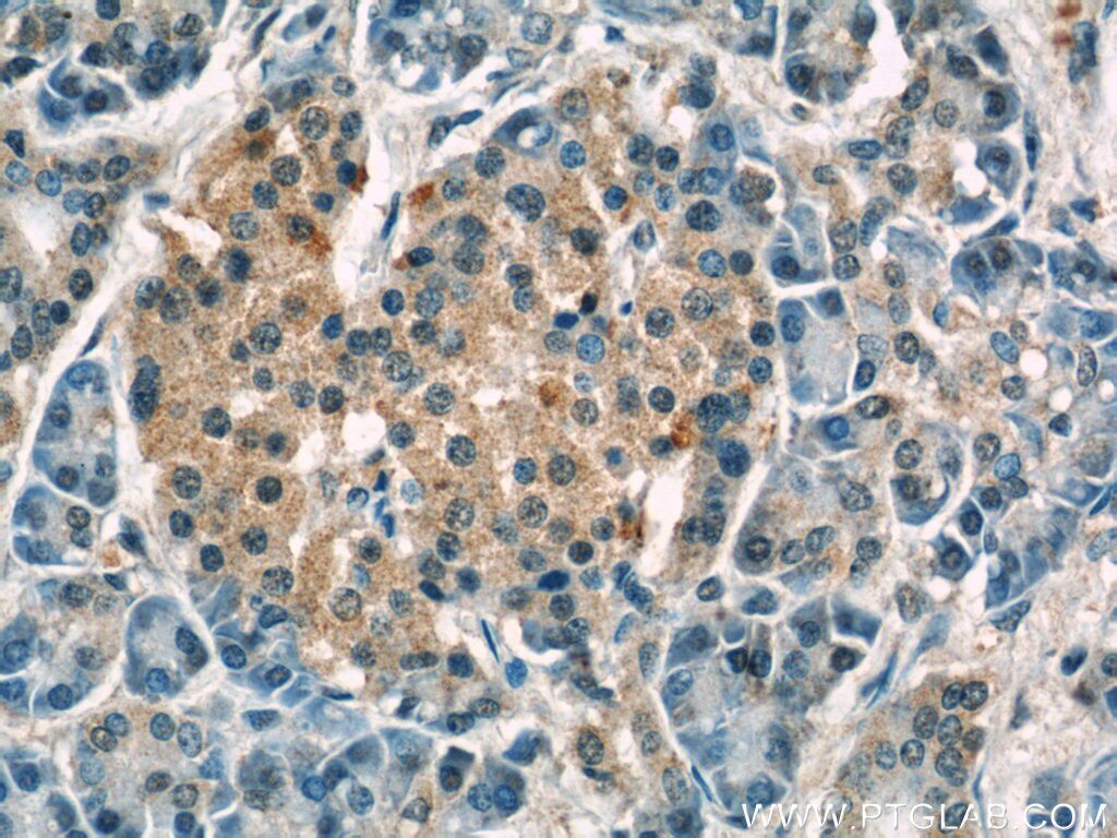 IHC staining of human pancreas using 23609-1-AP