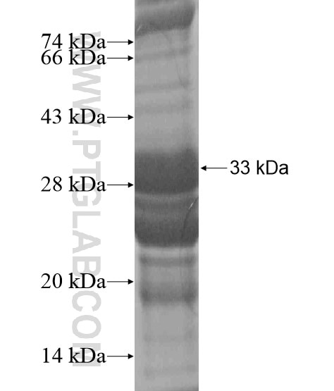 NPS fusion protein Ag20322 SDS-PAGE