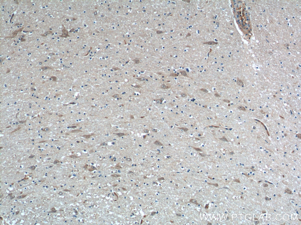 Immunohistochemistry (IHC) staining of human hypothalamus tissue using NPVF Polyclonal antibody (22311-1-AP)