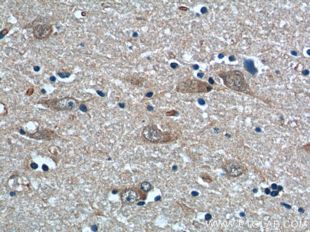 Immunohistochemistry (IHC) staining of human hypothalamus tissue using NPVF Polyclonal antibody (22311-1-AP)