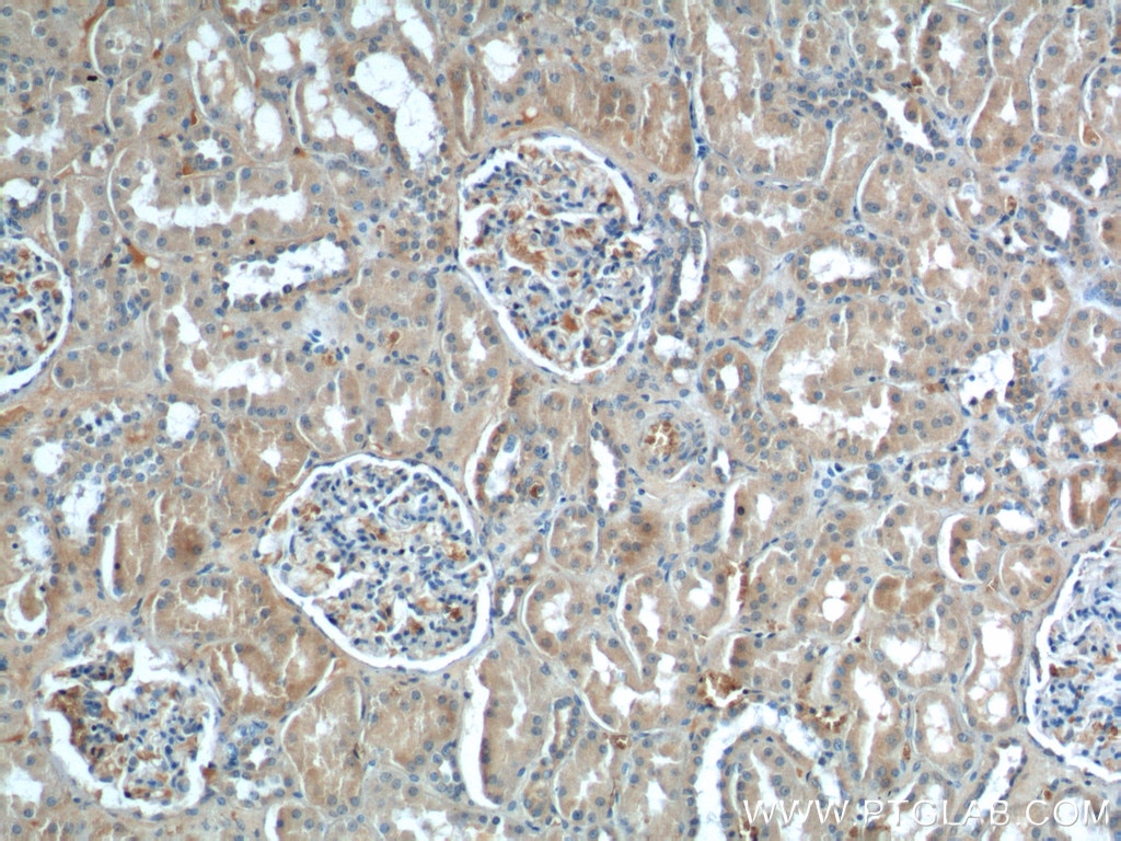 Immunohistochemistry (IHC) staining of human kidney tissue using NPVF Polyclonal antibody (22311-1-AP)