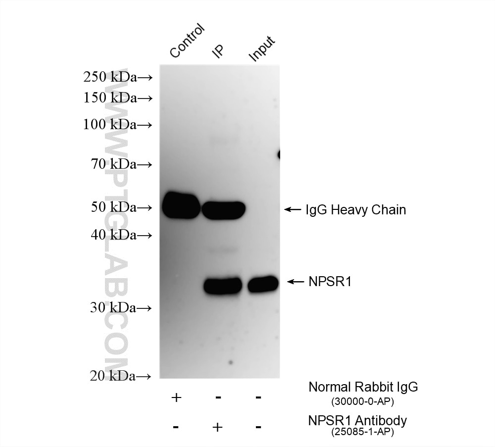 IP experiment of mouse lung using 25085-1-AP (same clone as 25085-1-PBS) Immunoprecipitation (IP) experiment of mouse lung tissue using NPSR1 Polyclonal antibody (25085-1-AP)