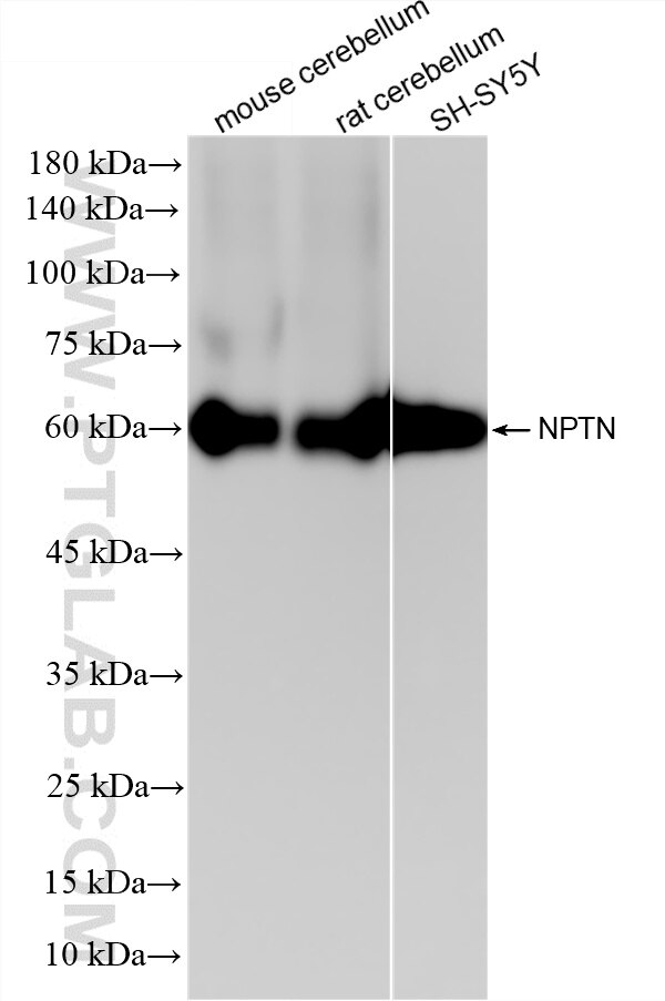 WB analysis using 87125-3-RR Western Blot (WB) analysis of various lysates using NPTN Recombinant monoclonal antibody (87125-3-RR)