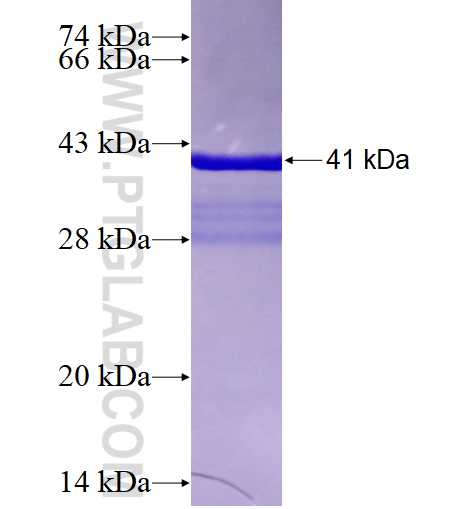 NPTN fusion protein Ag27752 SDS-PAGE