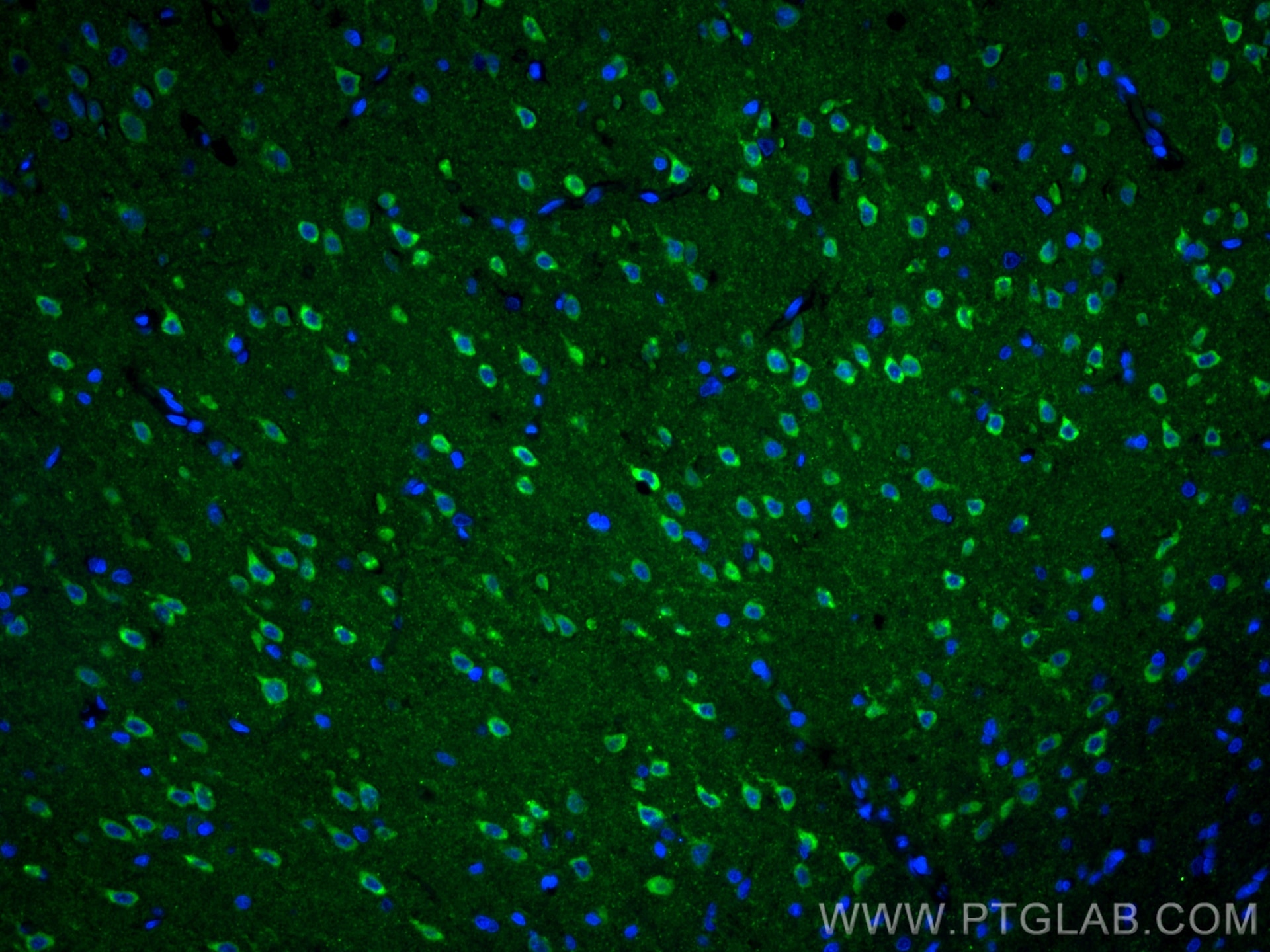 Immunofluorescence (IF) / fluorescent staining of rat brain tissue using NPTX1 Polyclonal antibody (20656-1-AP)
