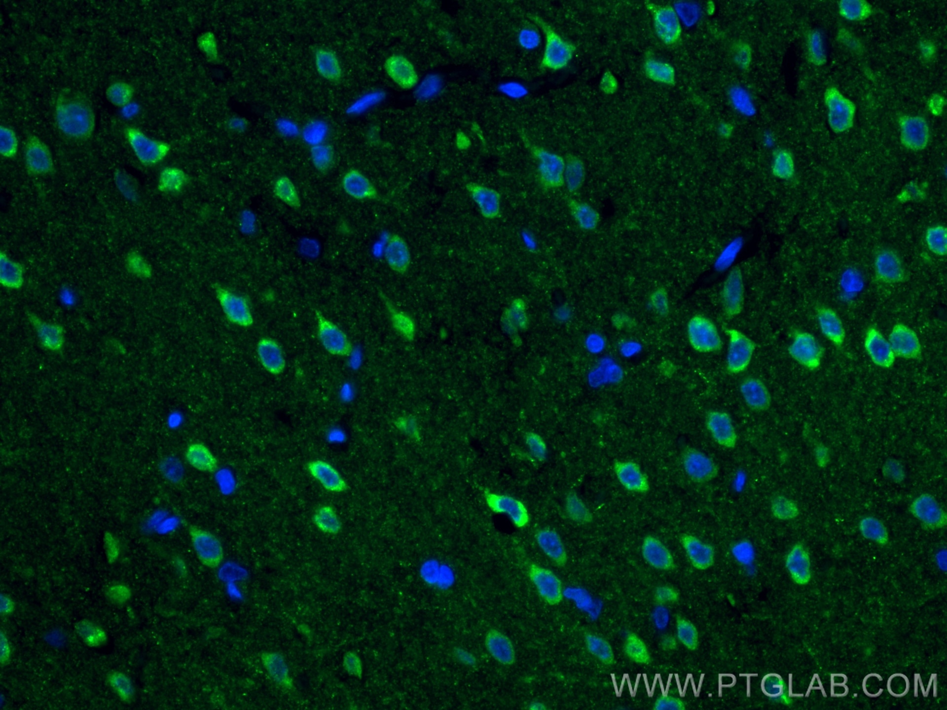 Immunofluorescence (IF) / fluorescent staining of rat brain tissue using NPTX1 Polyclonal antibody (20656-1-AP)