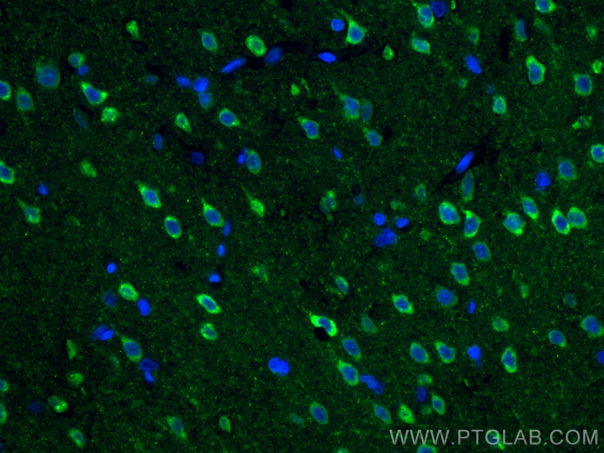 IF Staining of rat brain using 20656-1-AP