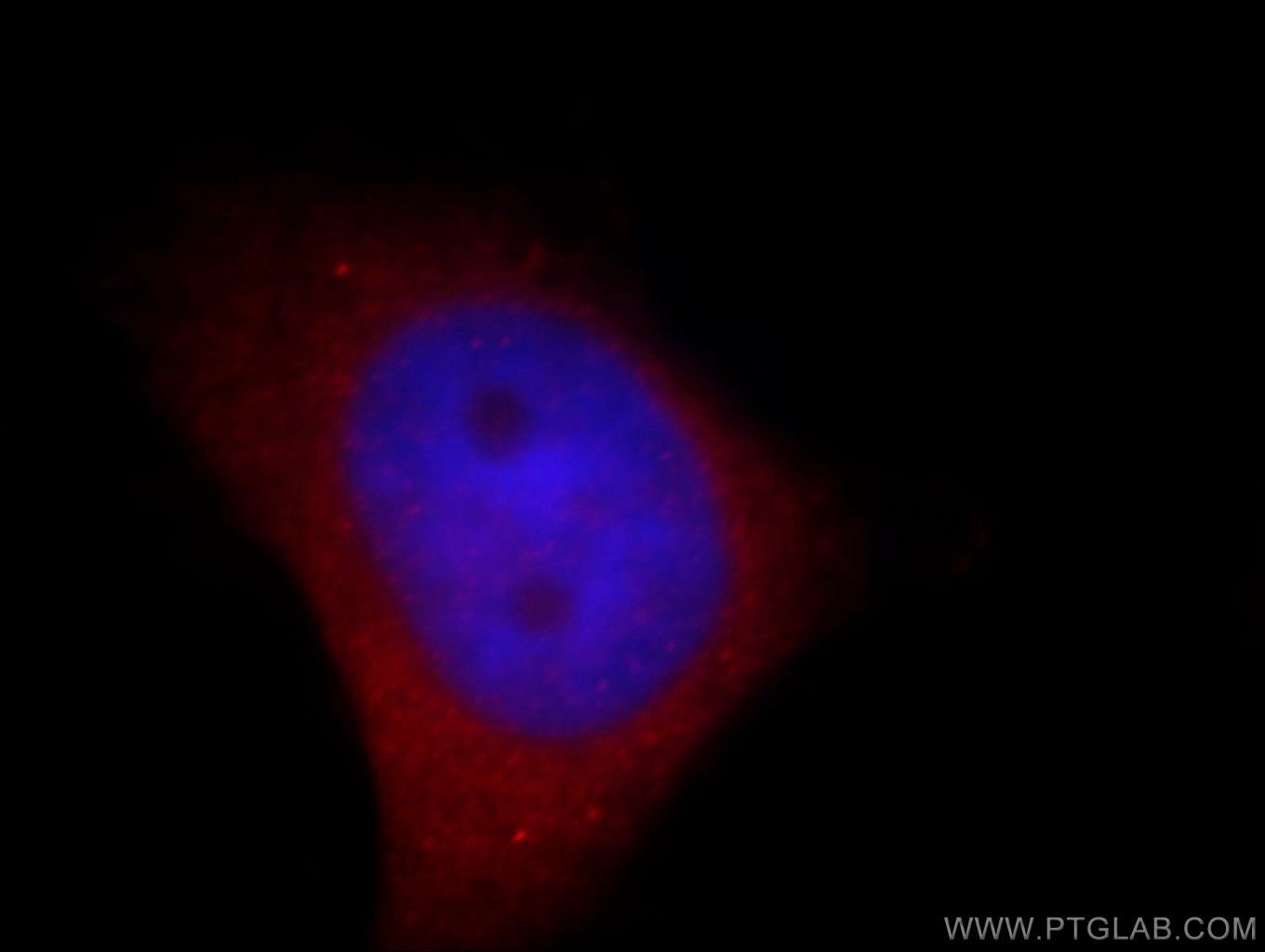 Immunofluorescence (IF) / fluorescent staining of HeLa cells using NPTX1 Polyclonal antibody (20656-1-AP)