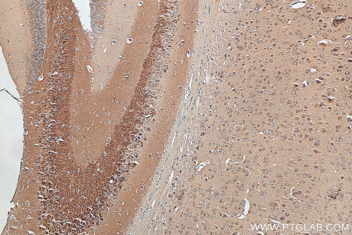 Immunohistochemistry (IHC) staining of mouse brain tissue using NPTX1 Polyclonal antibody (20656-1-AP)