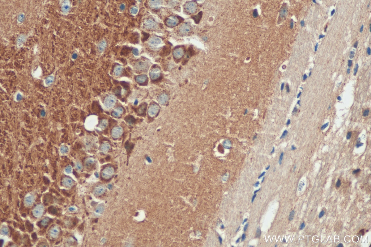 Immunohistochemistry (IHC) staining of mouse brain tissue using NPTX1 Polyclonal antibody (20656-1-AP)