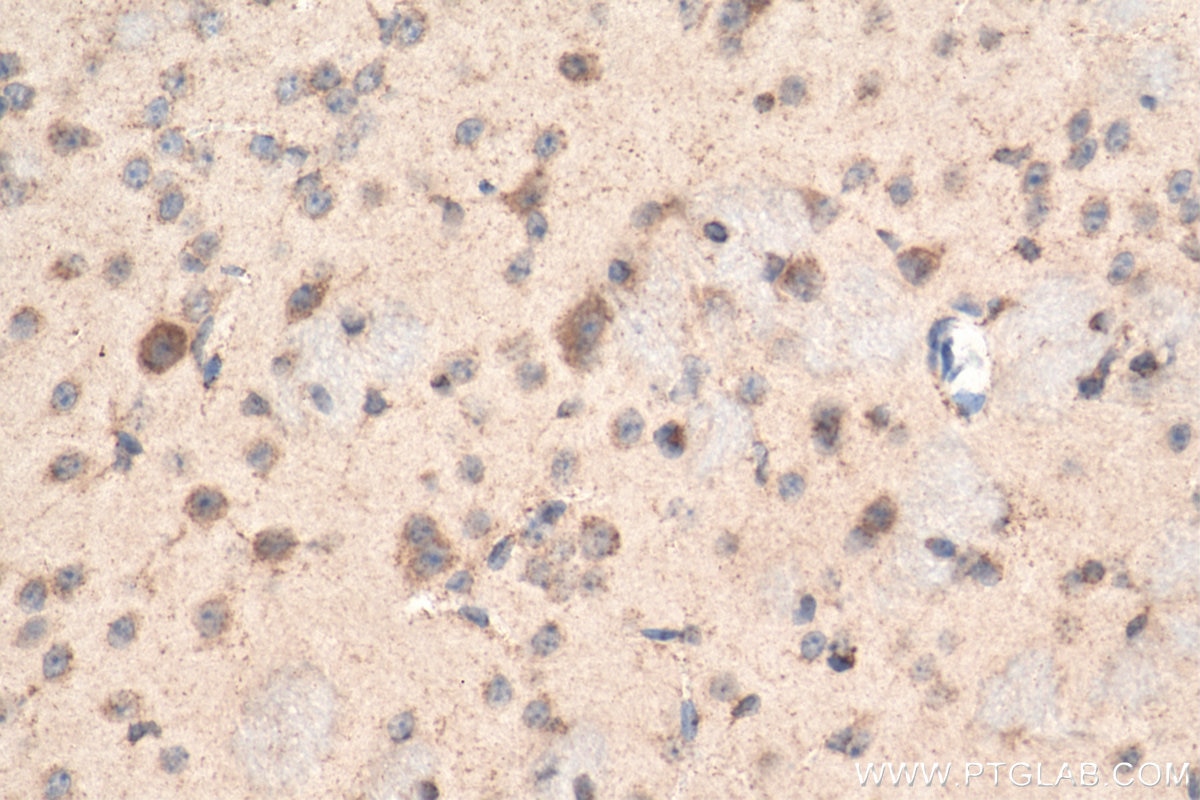 Immunohistochemistry (IHC) staining of mouse brain tissue using Biotin-conjugated NPTX1 Polyclonal antibody (Biotin-20656)