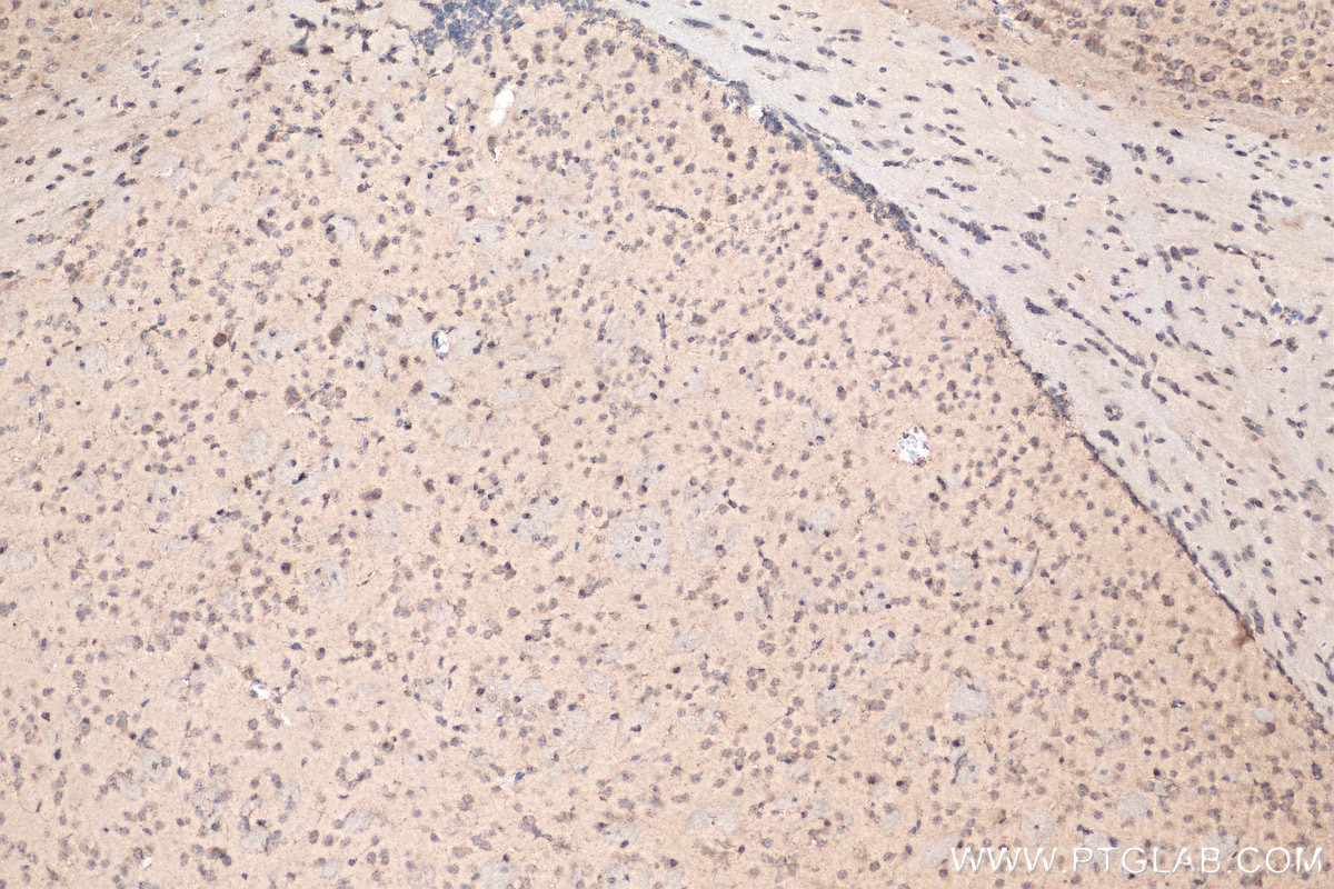 Immunohistochemistry (IHC) staining of mouse brain tissue using Biotin-conjugated NPTX1 Polyclonal antibody (Biotin-20656)