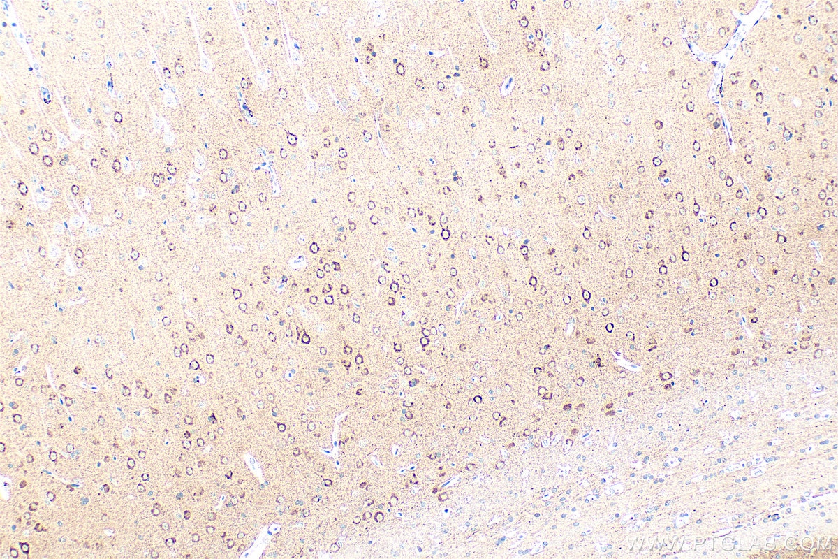 Immunohistochemical analysis of paraffin-embedded rat brain tissue slide using 10889-1-AP (NPTX2 antibody) at dilution of 1:800 (under 10x lens). Heat mediated antigen retrieval with Tris-EDTA buffer (pH 9.0). Immunohistochemistry (IHC) staining of rat brain tissue using NPTX2 Polyclonal antibody (10889-1-AP)