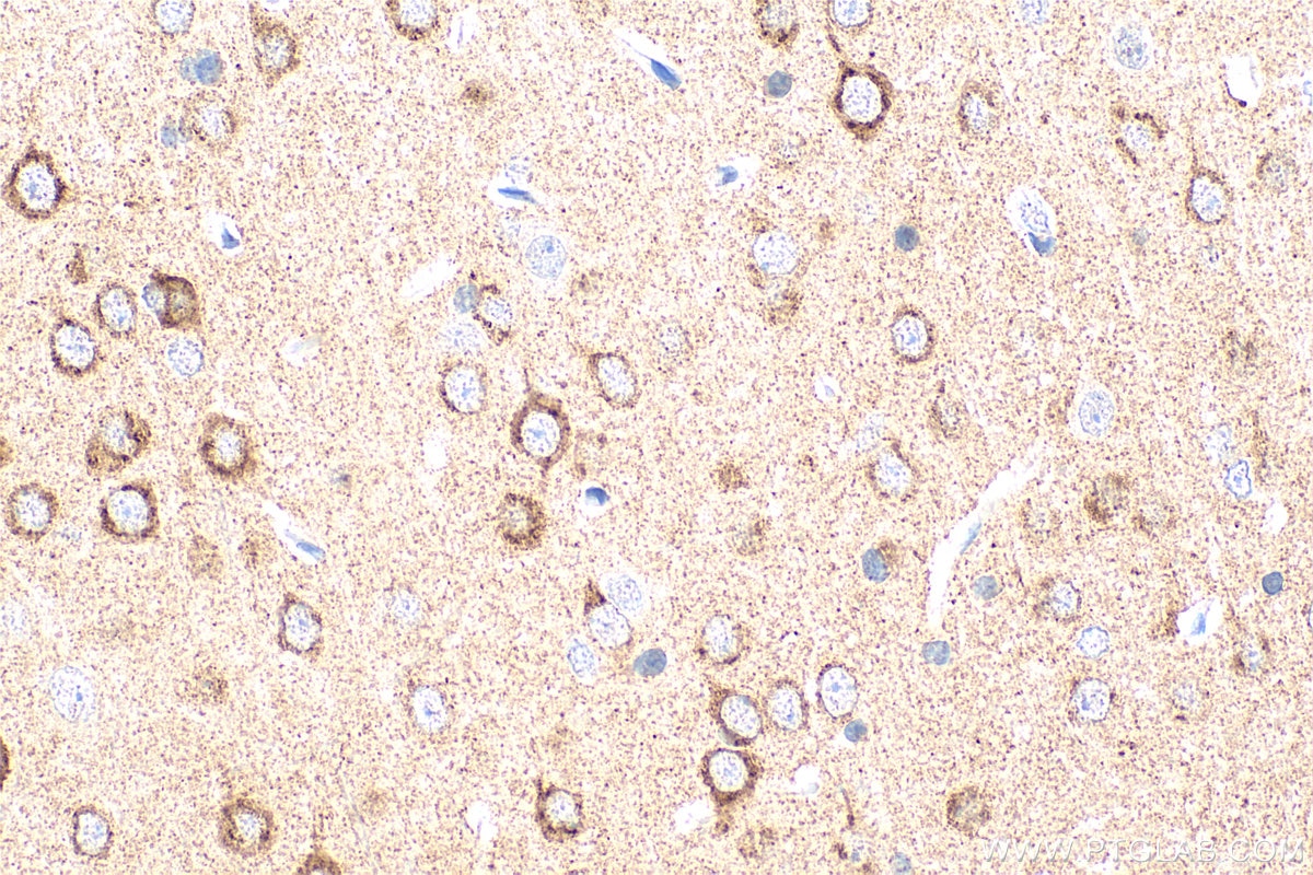 Immunohistochemical analysis of paraffin-embedded rat brain tissue slide using 10889-1-AP (NPTX2 antibody) at dilution of 1:800 (under 40x lens). Heat mediated antigen retrieval with Tris-EDTA buffer (pH 9.0). Immunohistochemistry (IHC) staining of rat brain tissue using NPTX2 Polyclonal antibody (10889-1-AP)