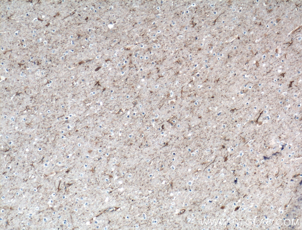 Immunohistochemistry (IHC) staining of human brain tissue using NPTX2 Polyclonal antibody (10889-1-AP)