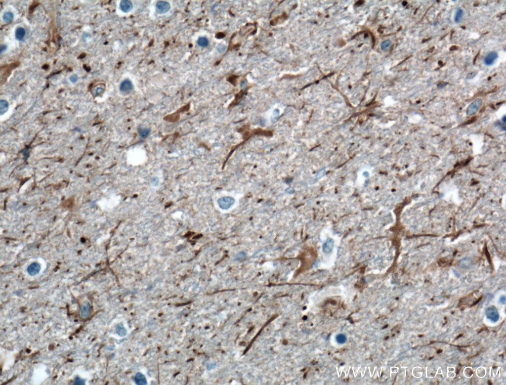 Immunohistochemistry (IHC) staining of human brain tissue using NPTX2 Polyclonal antibody (10889-1-AP)