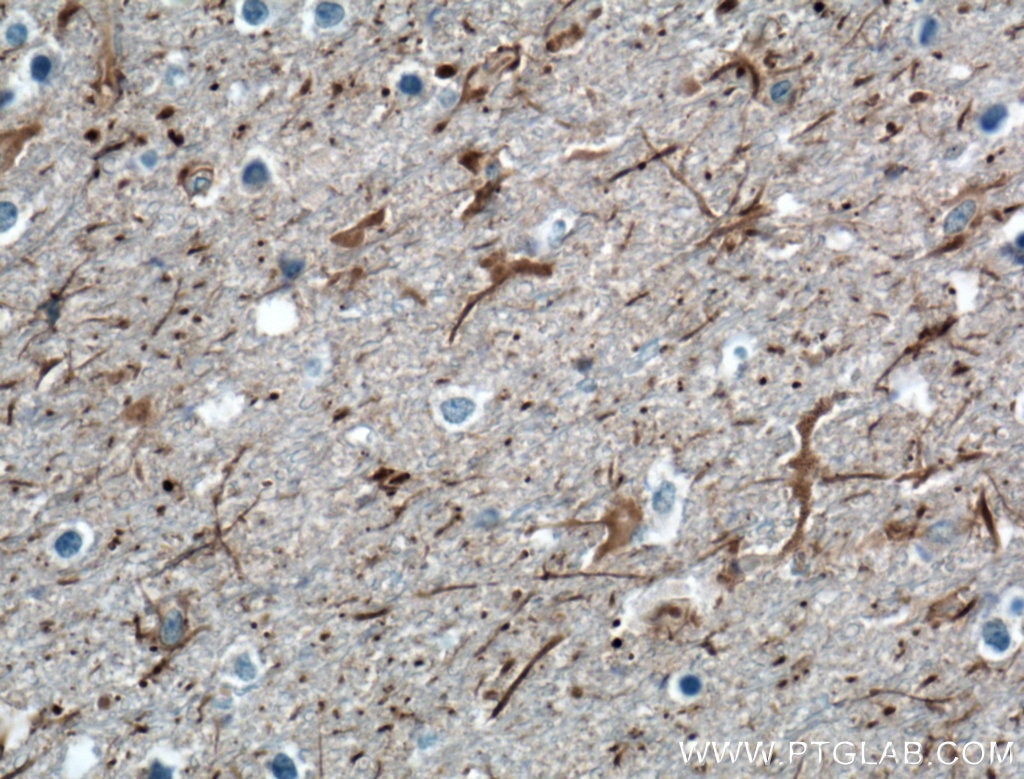 IHC staining of human brain using 10889-1-AP