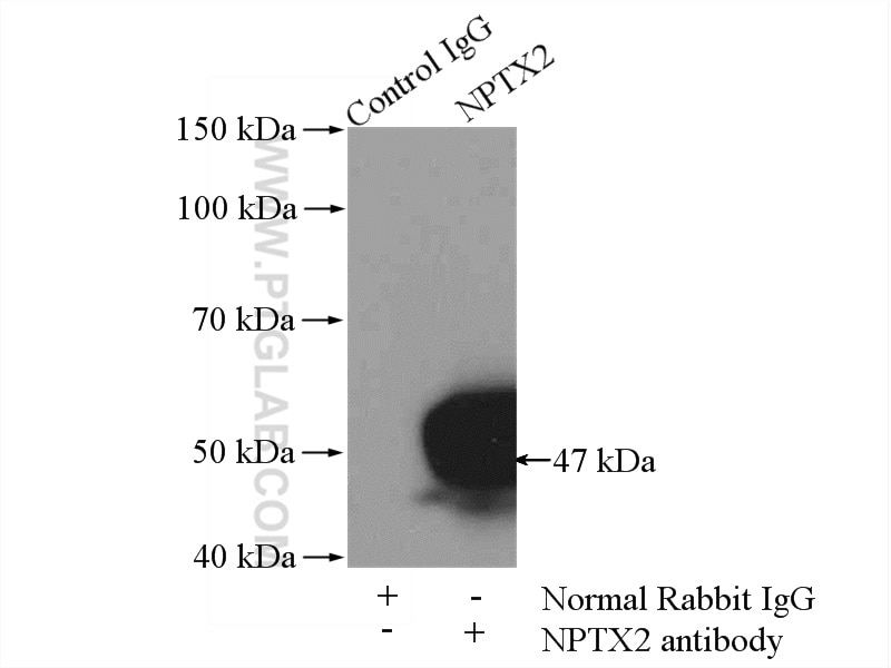 Immunoprecipitation (IP) experiment of mouse brain tissue using NPTX2 Polyclonal antibody (10889-1-AP)