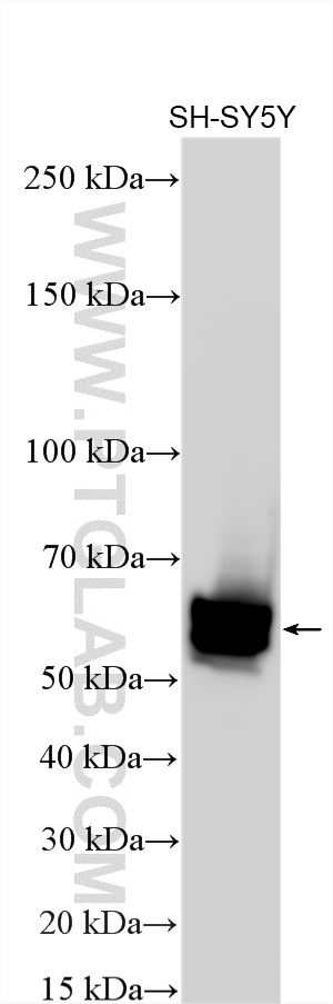 WB analysis using 10889-1-AP Western Blot (WB) analysis of various lysates using NPTX2 Polyclonal antibody (10889-1-AP)