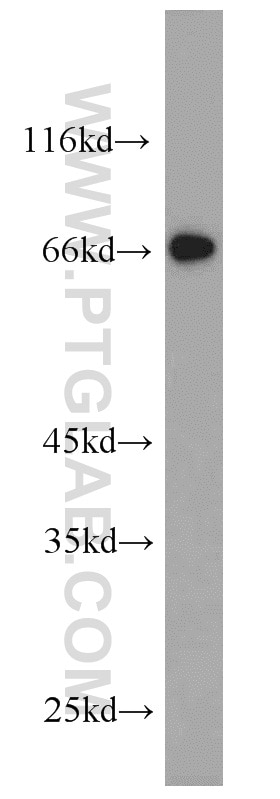 Western Blot (WB) analysis of SH-SY5Y cells using NPTX2 Polyclonal antibody (10889-1-AP)