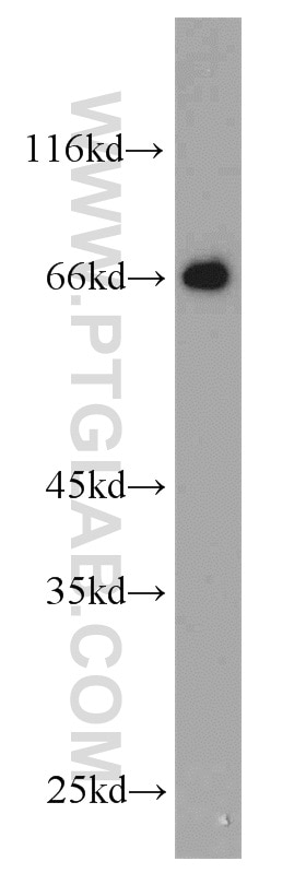 Western Blot (WB) analysis of PC-3 cells using NPTX2 Polyclonal antibody (10889-1-AP)