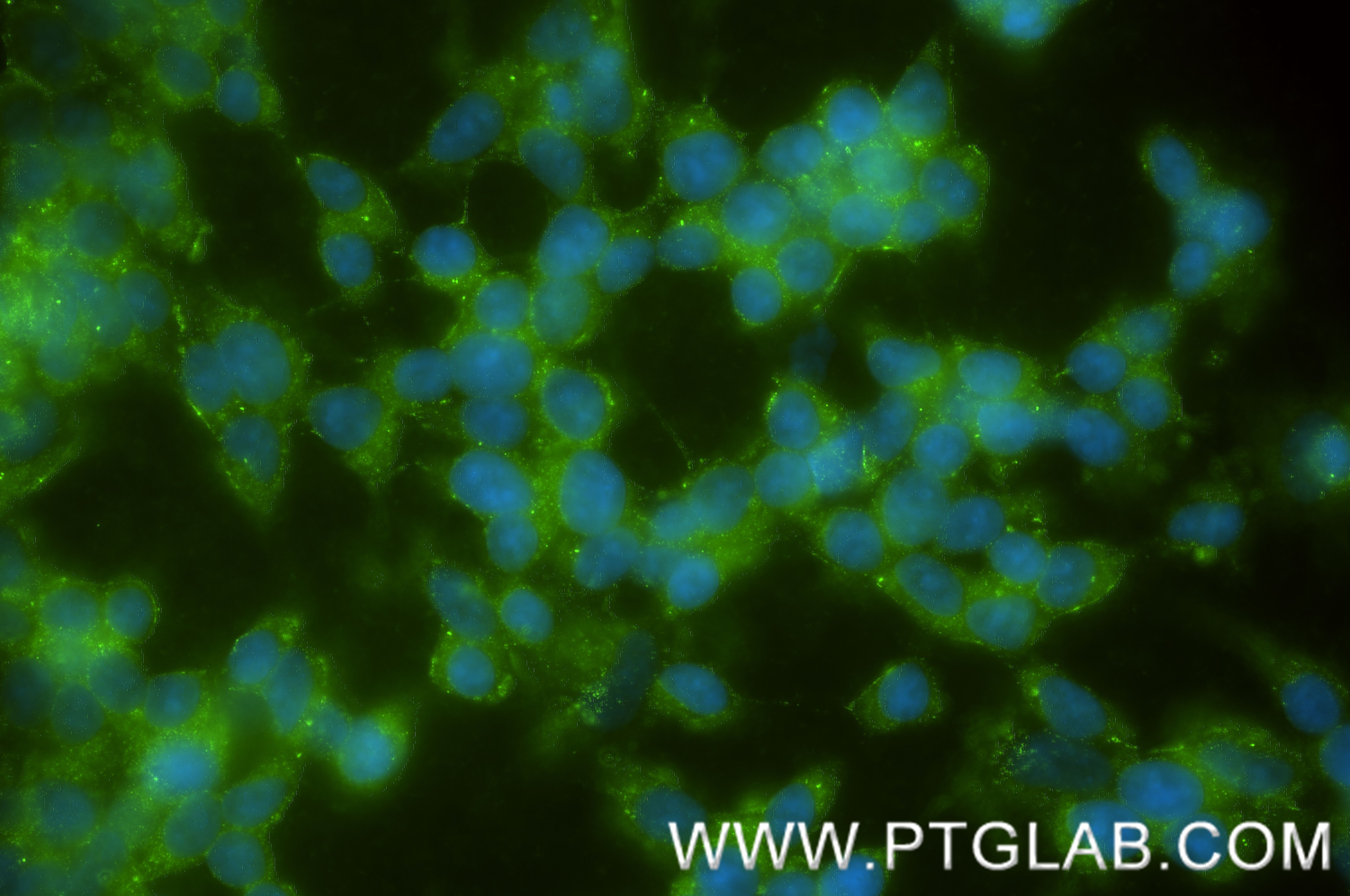 Immunofluorescence (IF) / fluorescent staining of SH-SY5Y cells using NPTX2 Recombinant monoclonal antibody (86203-1-RR)
