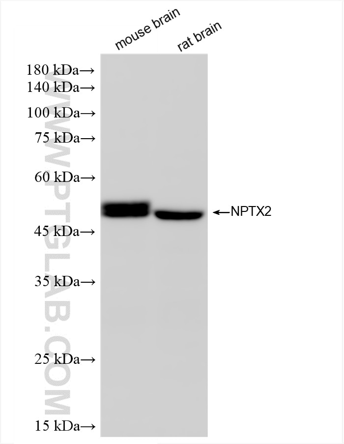 Western Blot (WB) analysis of various lysates using NPTX2 Recombinant antibody (86203-1-RR)