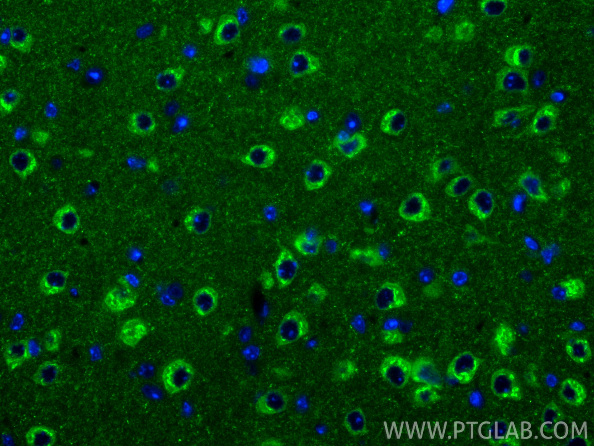 Immunofluorescence (IF) / fluorescent staining of mouse brain tissue using NPTXR Polyclonal antibody (24807-1-AP)