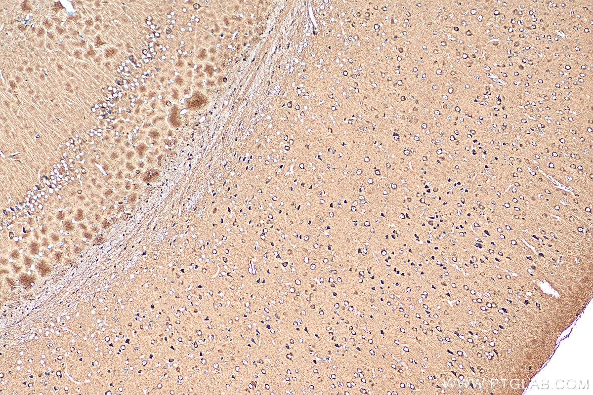 IHC staining of mouse brain using 24807-1-AP