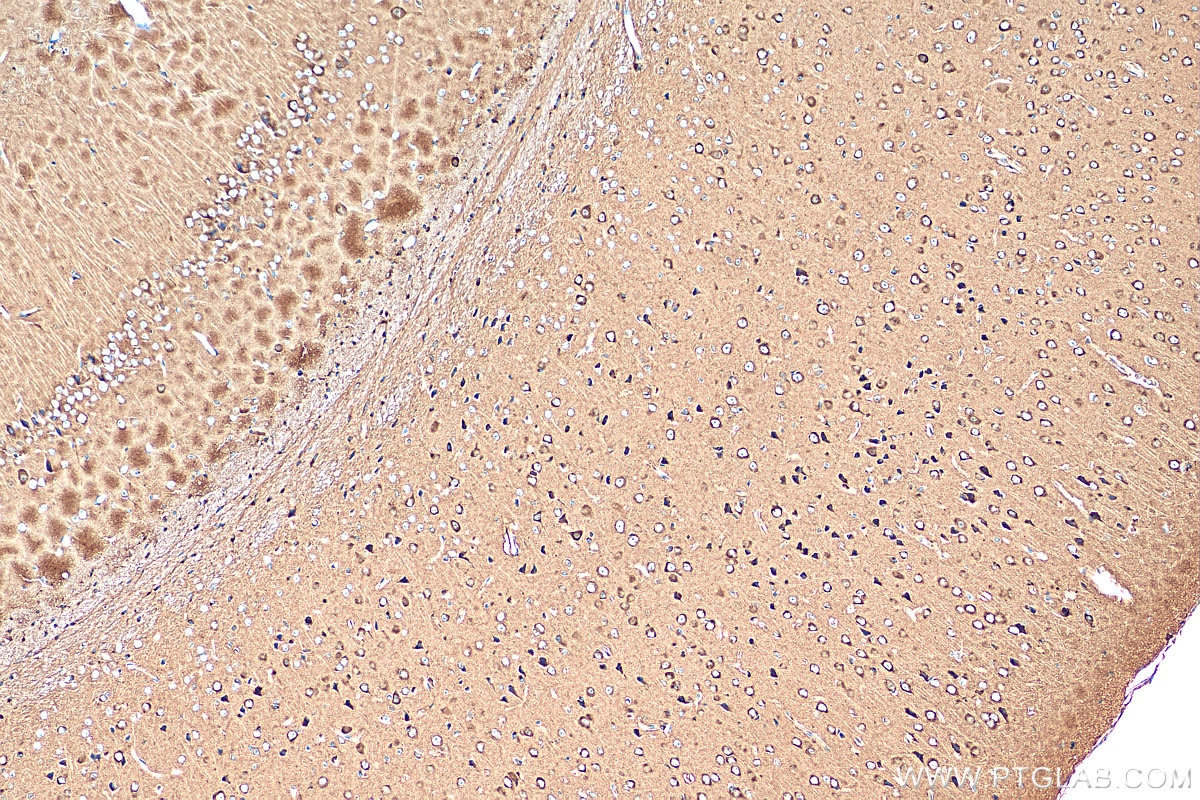 Immunohistochemistry (IHC) staining of mouse brain tissue using NPTXR Polyclonal antibody (24807-1-AP)