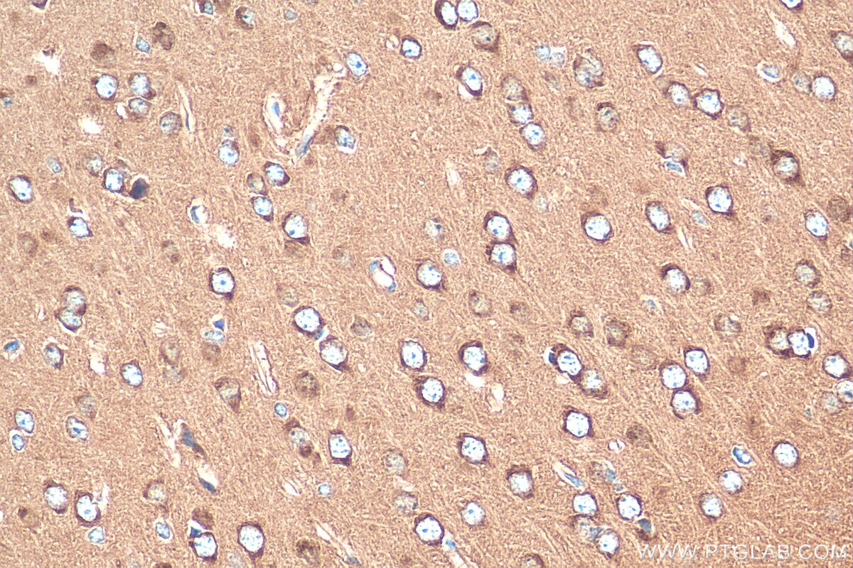 Immunohistochemistry (IHC) staining of mouse brain tissue using NPTXR Polyclonal antibody (24807-1-AP)