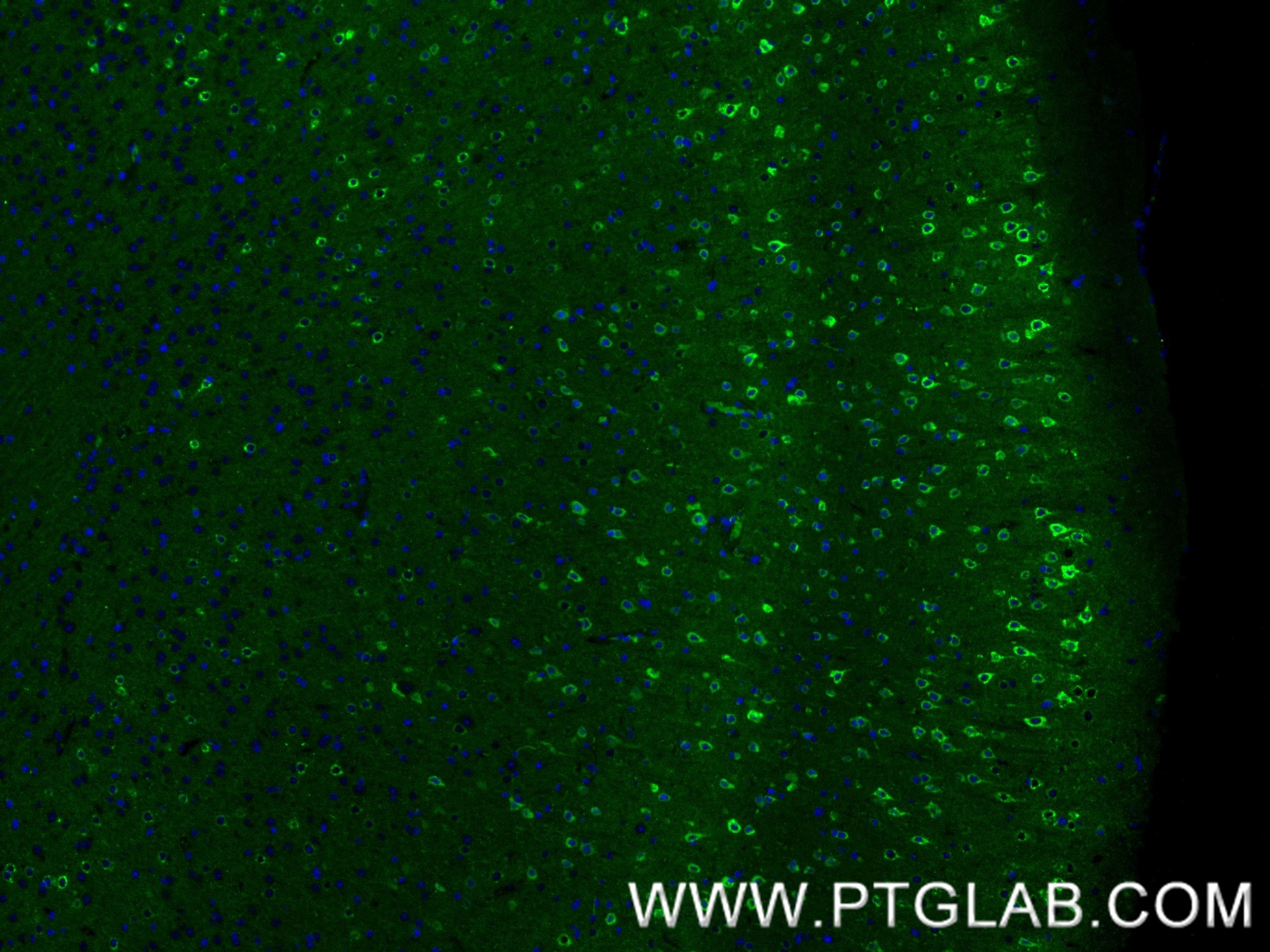 Immunofluorescence (IF) / fluorescent staining of mouse brain tissue using NPTXR Recombinant monoclonal antibody (85994-1-RR)