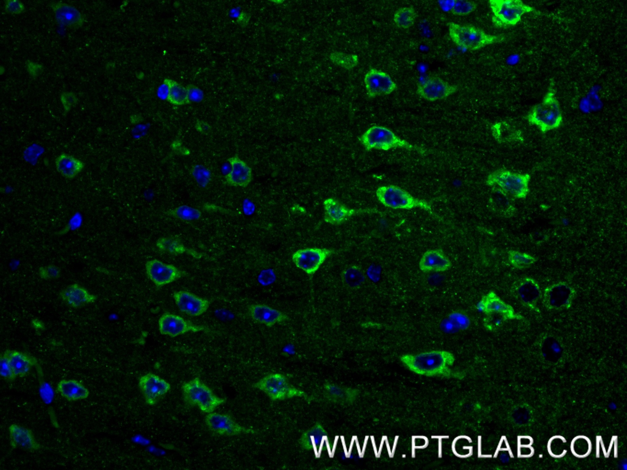 Immunofluorescence (IF) / fluorescent staining of mouse brain tissue using NPTXR Recombinant monoclonal antibody (85994-1-RR)